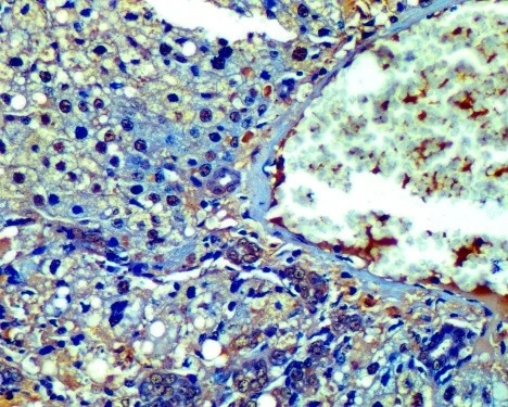 Immunohistochemistry Services